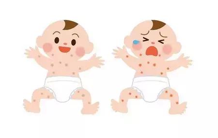 宝宝湿疹和痱子可不一样，这个方法学会了，对付湿疹最好了！