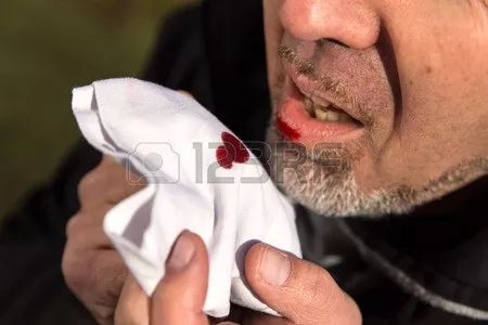 肺栓塞抗凝治疗咯血怎么办,肺栓塞溶完栓2个月又咯血怎么办