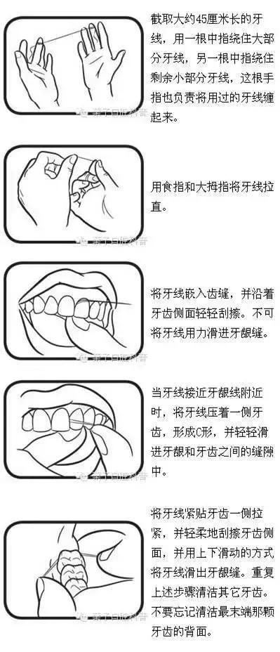 原来蛀牙是这样修复,牙齿开始蛀牙怎样防止恶化