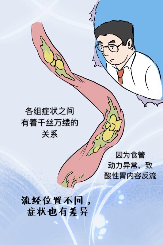 反酸烧心食管堵得慌是怎么回事,胃堵反酸烧心吃什么药