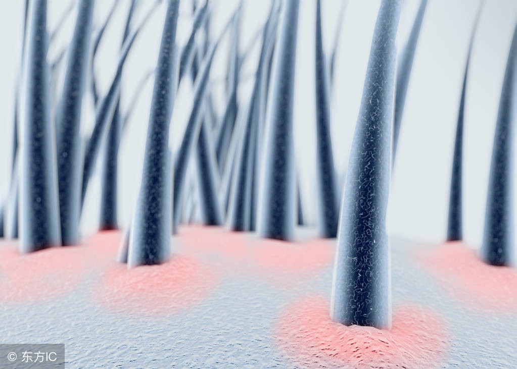 关于脱发斑秃病因你知多少,斑秃脂溢性脱发怎么生发和增发