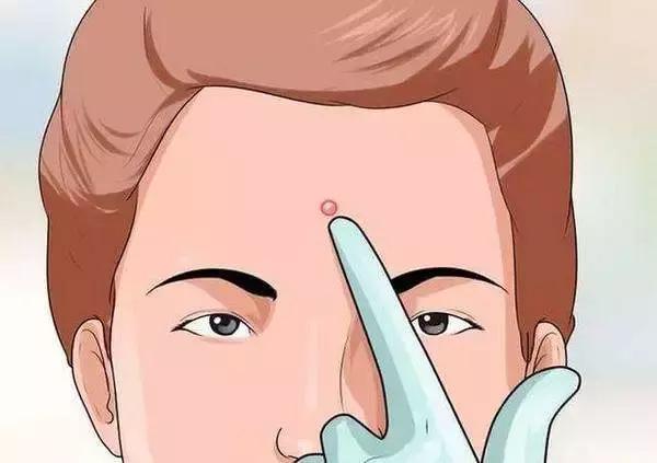 螨虫在皮肤里边跑痒怎么处理,螨虫肆虐背部