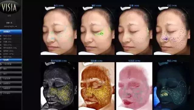 皮肤检测仪从三个层次分析,皮肤检测仪帮你判断皮肤问题