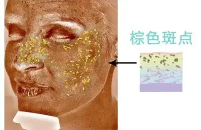 皮肤检测仪从三个层次分析,皮肤检测仪帮你判断皮肤问题