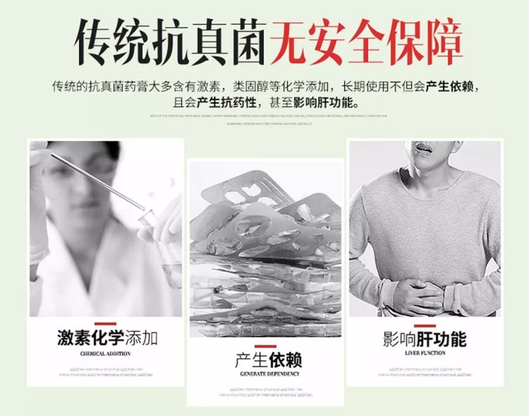 正品脚气脚臭杀菌止痒软膏,脚气克星脚气膏