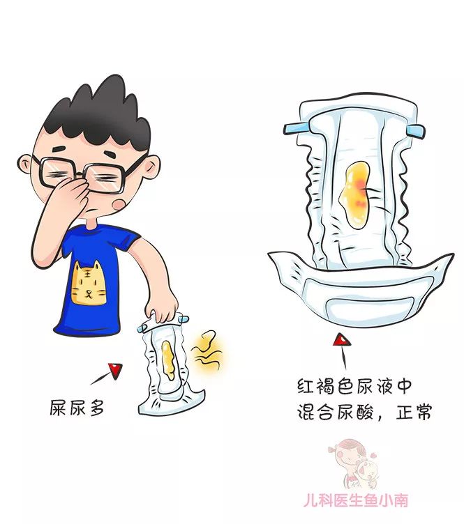 如何辨别婴儿大便性状,宝宝大便性状有哪些