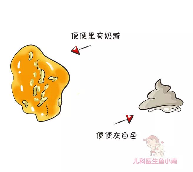 如何辨别婴儿大便性状,宝宝大便性状有哪些
