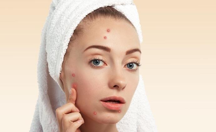 真正有效的祛痘产品排行榜10强,祛痘产品前十强品牌