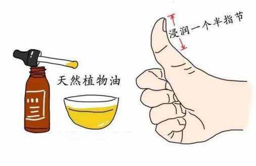 顺产后怕侧切怎么办,顺产为什么要外阴侧切