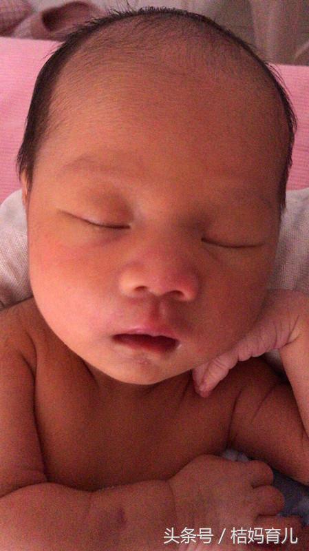 孕35周+5早产6斤男宝，顺转剖，给还未生产的宝妈1点建议！