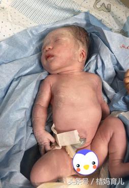 孕35周+5早产6斤男宝，顺转剖，给还未生产的宝妈1点建议！