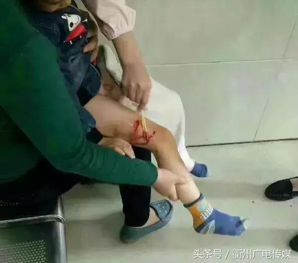 被狗咬住不放怎么办,被狗咬着不松口怎么快速脱离