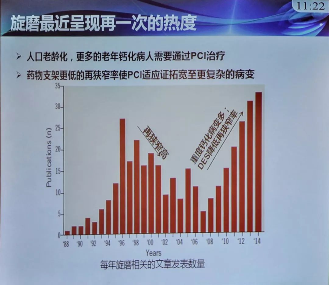 CICI2018丨旋磨治疗的最佳操作模式
