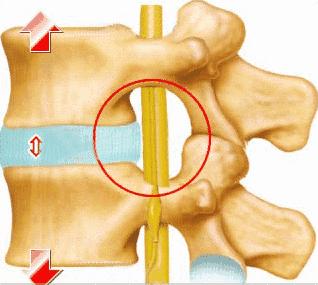 中医养生大讲堂治腰间盘突出,中医讲堂腰椎间盘突出