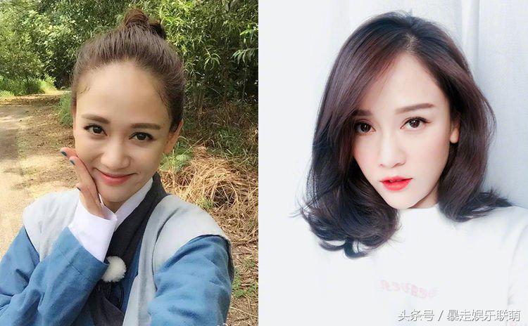 女星发际线后移怎么补救,女明星的发际线怎么改善的