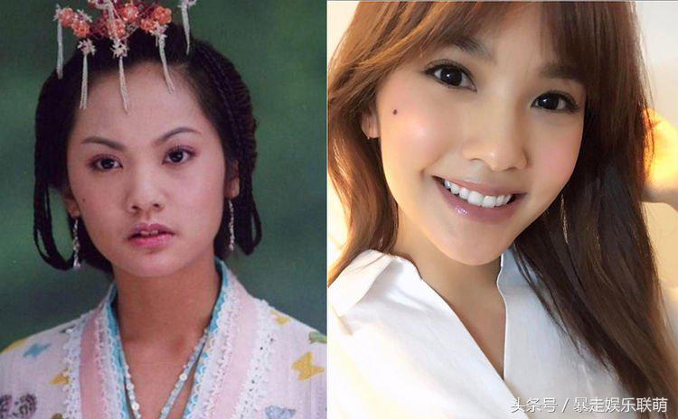 女星发际线后移怎么补救,女明星的发际线怎么改善的