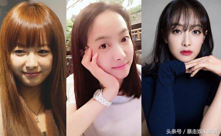 女星发际线后移怎么补救,女明星的发际线怎么改善的