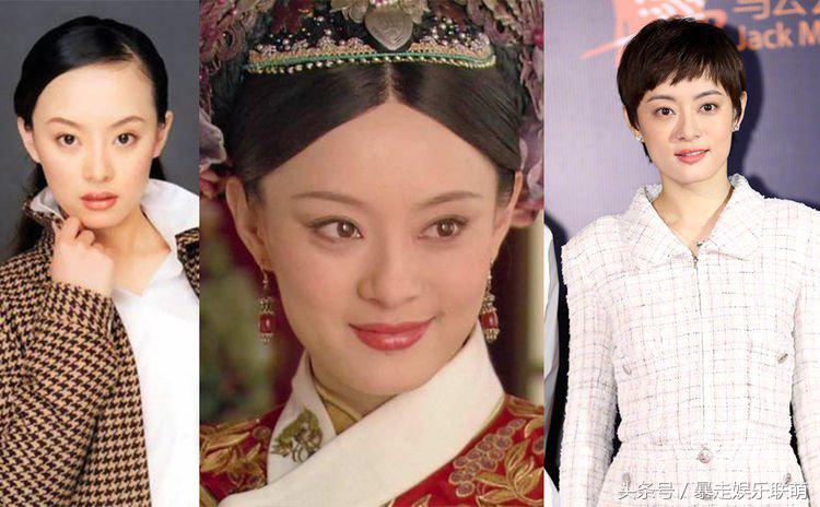 女星发际线后移怎么补救,女明星的发际线怎么改善的