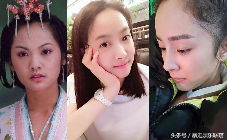 女星发际线后移怎么补救,女明星的发际线怎么改善的