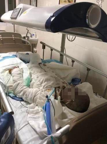 学生在出租屋洗澡煤气中毒,广州一女孩出租屋煤气中毒