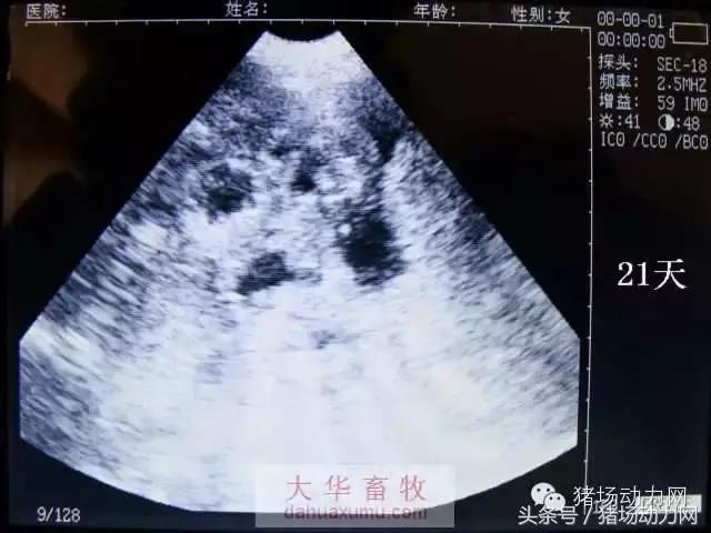 母猪b超图像如何看,怀孕100天的母猪b超影像