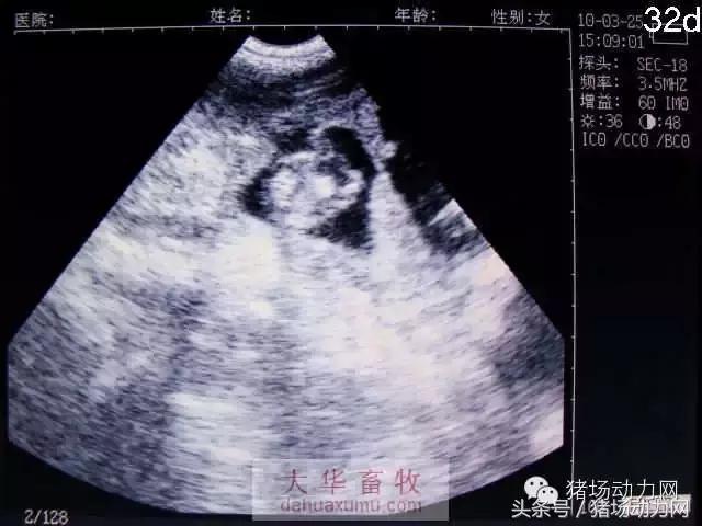 母猪b超图像如何看,怀孕100天的母猪b超影像