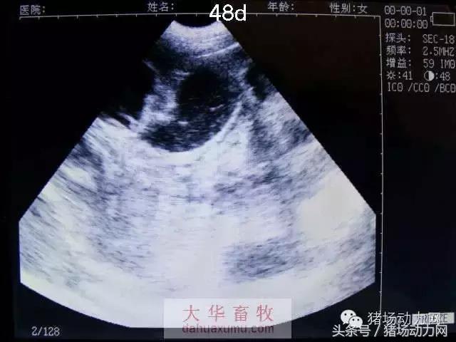 母猪b超图像如何看,怀孕100天的母猪b超影像