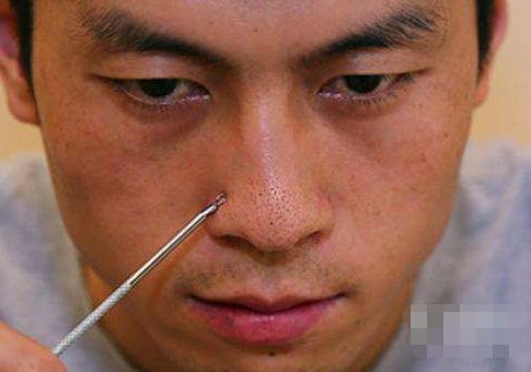 鼻子有黑头不用挤教你一招,鼻子挤黑头留下的小洞怎么收缩