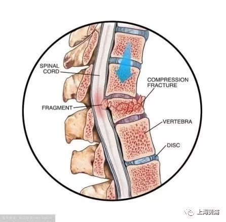 我不是药神致敬电影,我不是药神健身视频