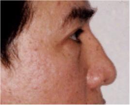 面相几种鼻型的图片,面相鼻子的几种类型图解