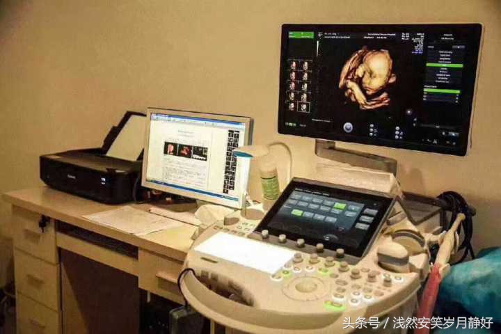 临沂和美家四维彩超是199吗,临沂和美家四维彩超的价格