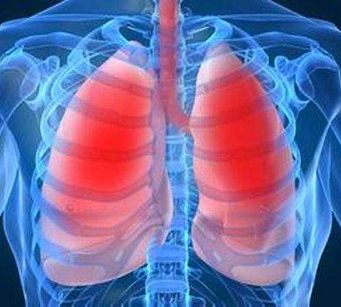 放疗放射性肺炎能好吗,放疗放射性肺炎