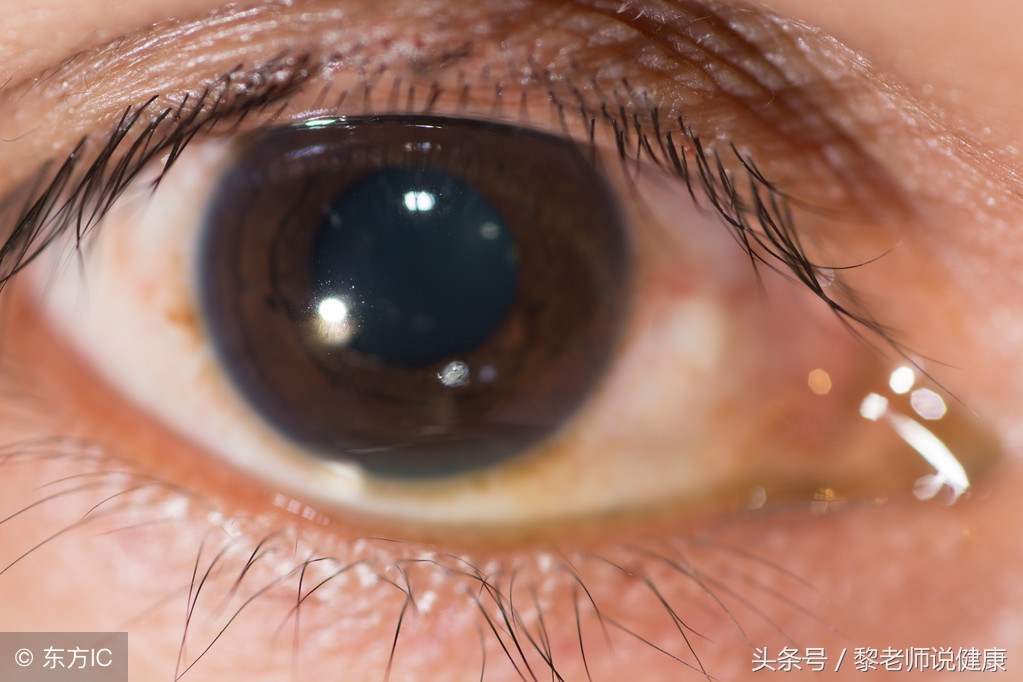 眼睛泛红血丝疼痛由什么引起的,眼睛红血丝肿痛用什么药