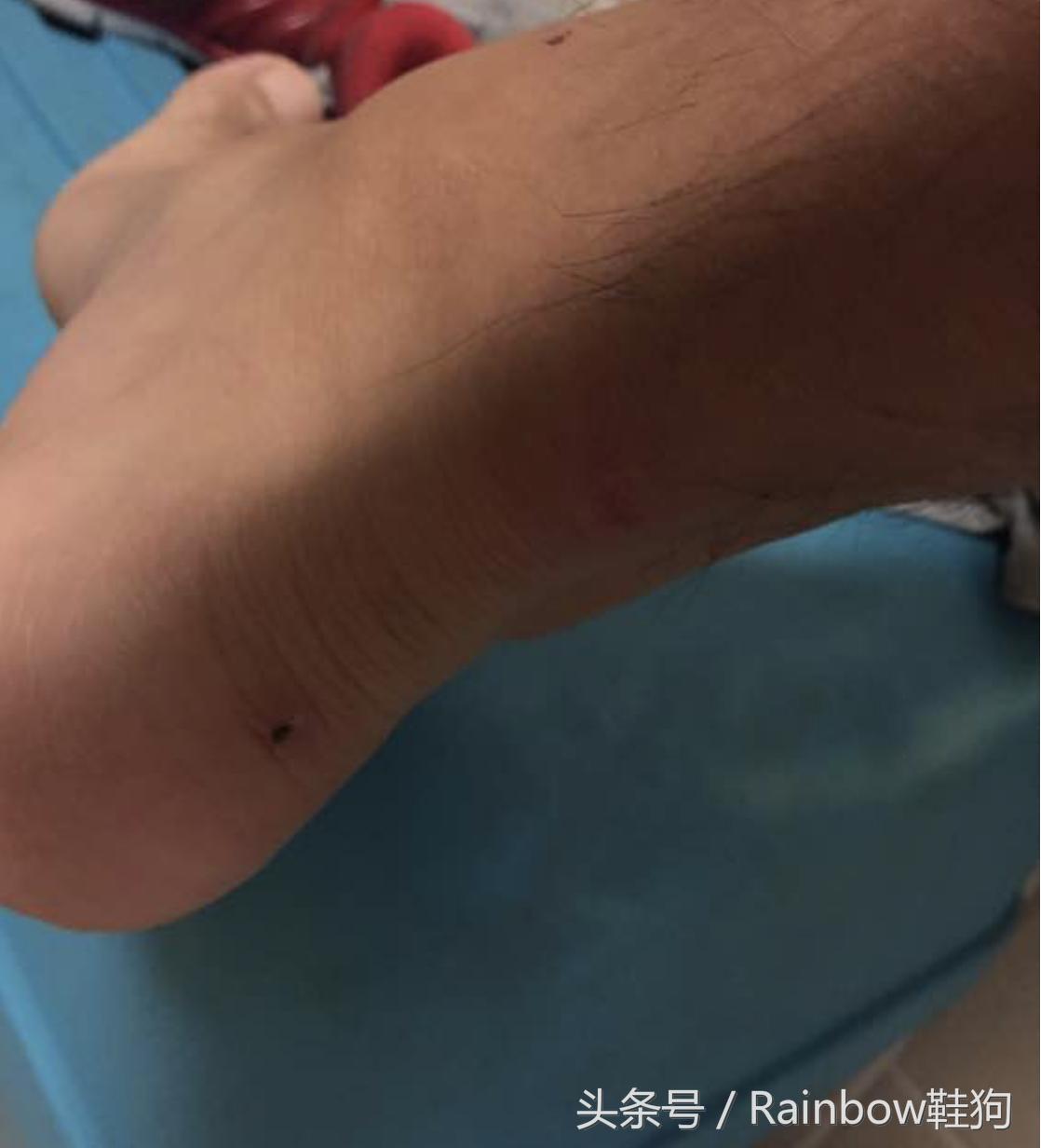 aj1影子灰磨脚咋办,aj1鞋子修复长沙