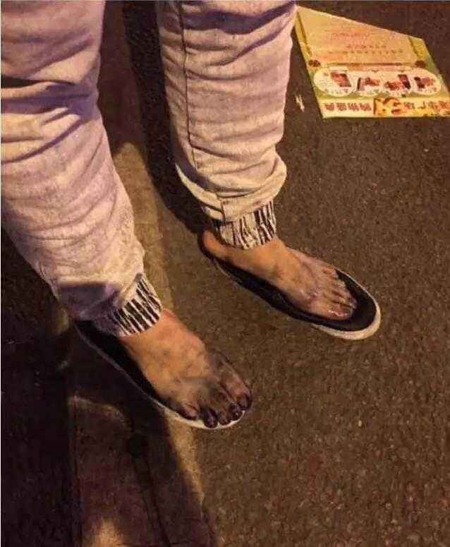 凉鞋掉色染脚会对身体有害吗,买的凉鞋掉色