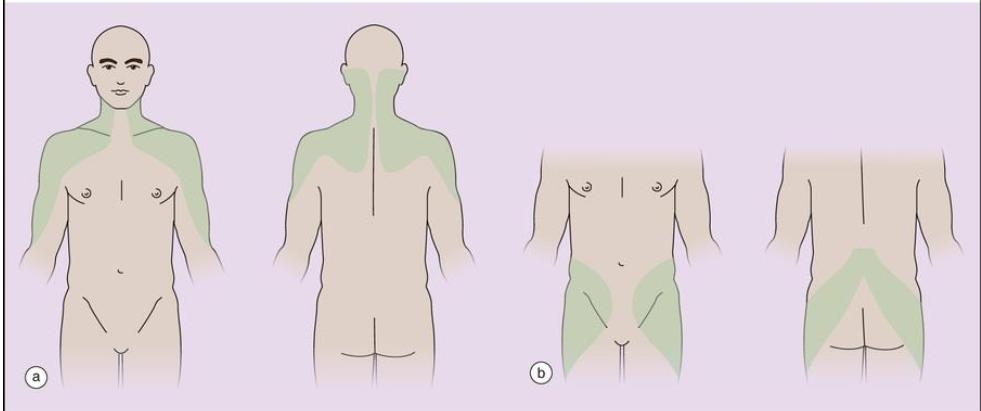 老年不明原因发热,老年人无症状发烧是怎么回事