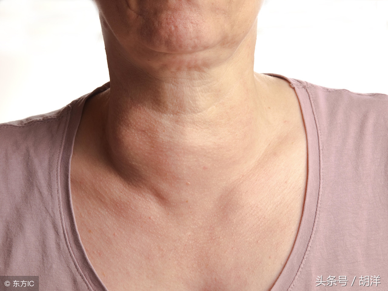 莫名脚肿了有后续吗,莫名其妙的脚肿查不出什么原因