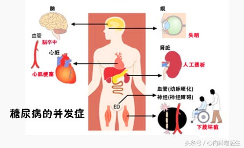 老年人空腹血糖正常餐后血糖超标,老年人血糖空腹多少为正常