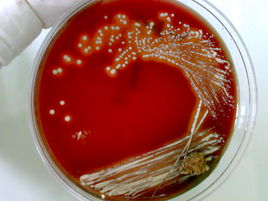 为什么别人的青春期没有痘痘?本期文章不藏私战痘好物起底