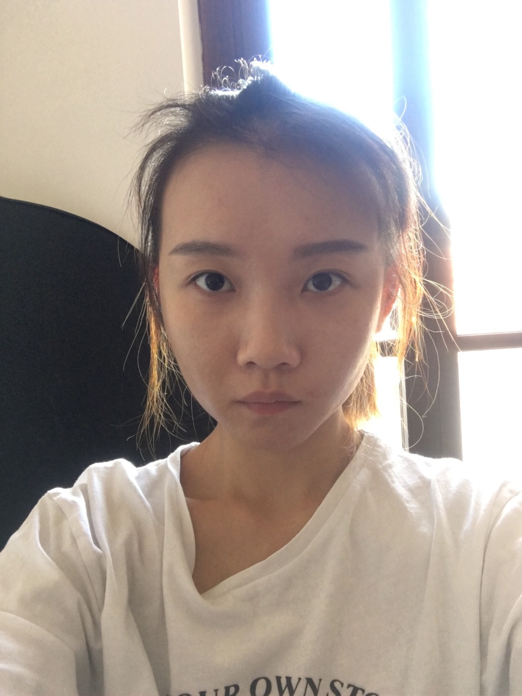 为什么别人的青春期没有痘痘?本期文章不藏私战痘好物起底