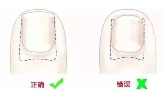 宝宝清洁过度怎样护理,婴儿夏季清洁护理