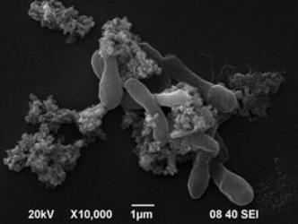 乳酸菌和芽孢杆菌可以一起发酵吗,凝结芽孢杆菌属于乳酸菌吗