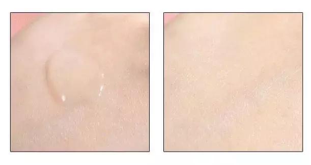 盛夏都快过完了,听说你的大腿还没变白?