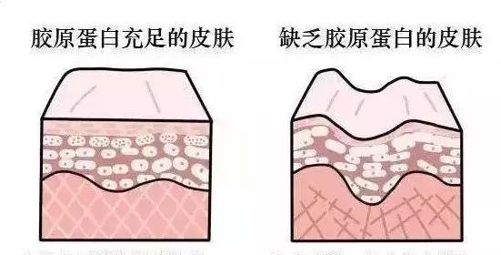 毛孔粗得像橘子皮,毛孔像草莓一样怎么办