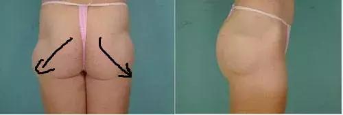 假胯宽屁股大腿粗小个子裤子,假胯宽屁股大腿粗