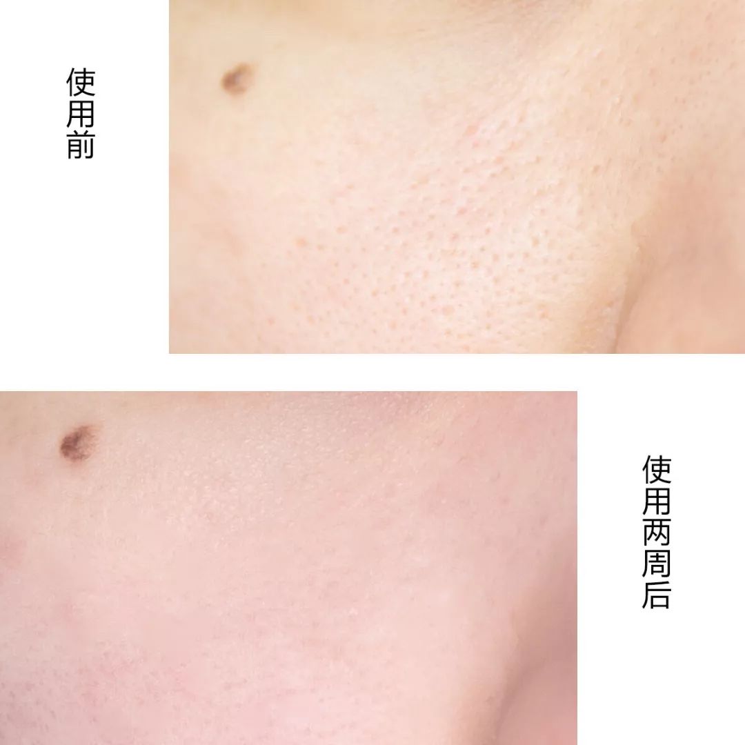 刘大神喜提阿汤哥，又顺手抛来一份缩毛孔秘籍