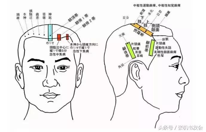 针灸按摩全息图(收藏版)