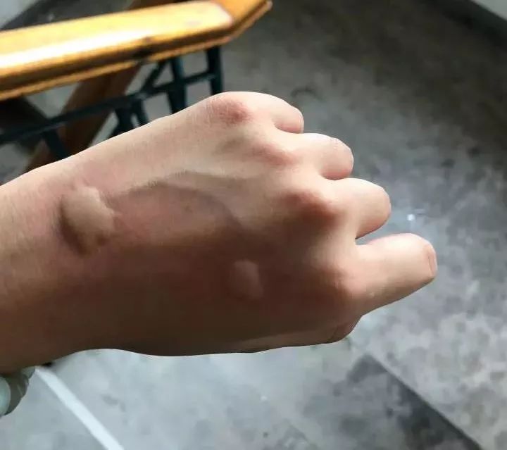 对不起，你永远都不可能是蚊子的对手