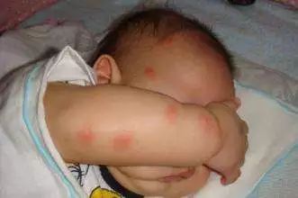 对不起，你永远都不可能是蚊子的对手