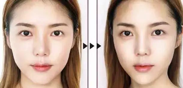 不用动刀整容也可以拥有高鼻梁,整形要整高鼻梁